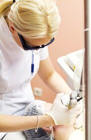 医師が光熱分解処置を行う