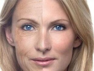 皮膚の色素沈着