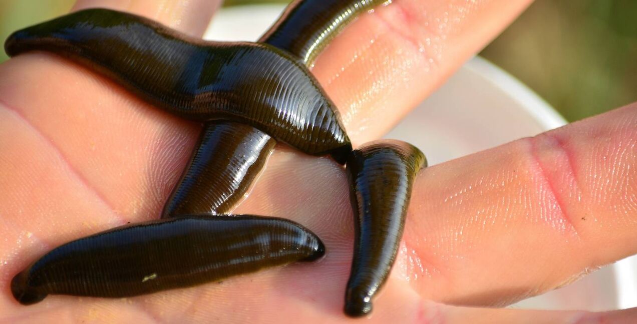 顔の皮膚の若返り方法としてのヒルドセラピー